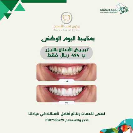 عروض اليوم الوطني 94 - عروض مركز زركون لطب الأسنان خصم على جميع الخدمات حتى 70% 2 1834534864